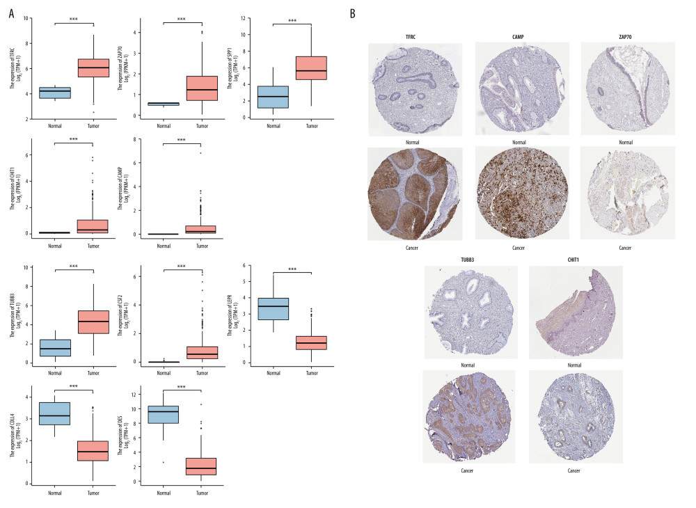 The expression levels of hub immune-related genes in cervical normal and cancer tissues.(A) The mRNA expression of 10 hub immune-related genes in cervical normal and cancer tissues. (B) The immunostaining of TFRC, CAMP, ZAP70, TUBB3, and CHIT1 in cervical cancer tissues and normal tissues.