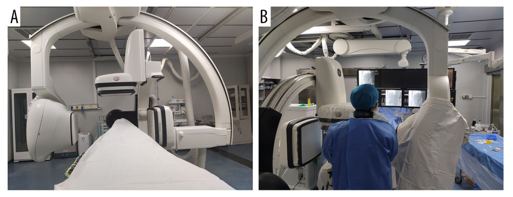 Operating the machine and doctor’s position. (A) The double C-arm digital subtraction angiography system. (B) Position of the operator and operation process. Image Software: Adobe Photoshop, CS6, Adobe Systems.