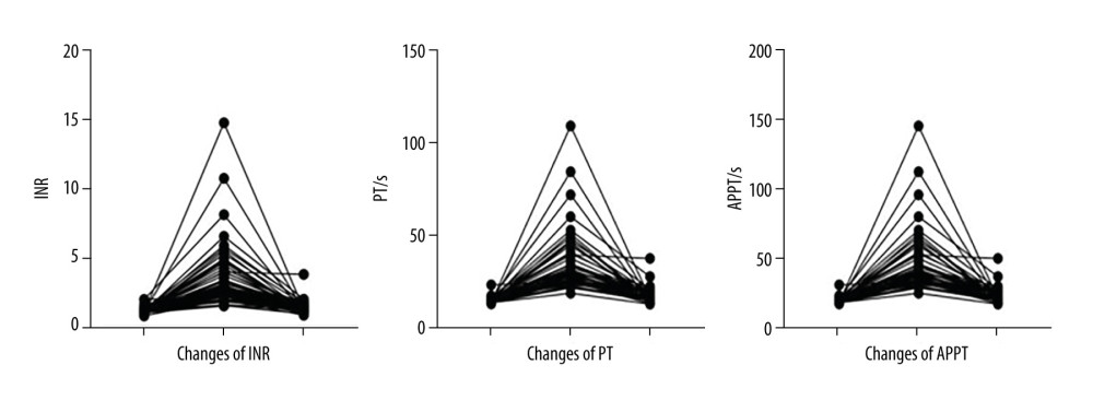 After cefoperazone/sulbactam administration, the international normalized ratio (INR) increased significantly and prothrombin time (PT) and activated partial thrombin time (APTT) were prolonged, suggesting coagulation dysfunction. After treatment with vitamin K1, the INR decreased and PT and APTT were shortened, suggesting that coagulation function improved.