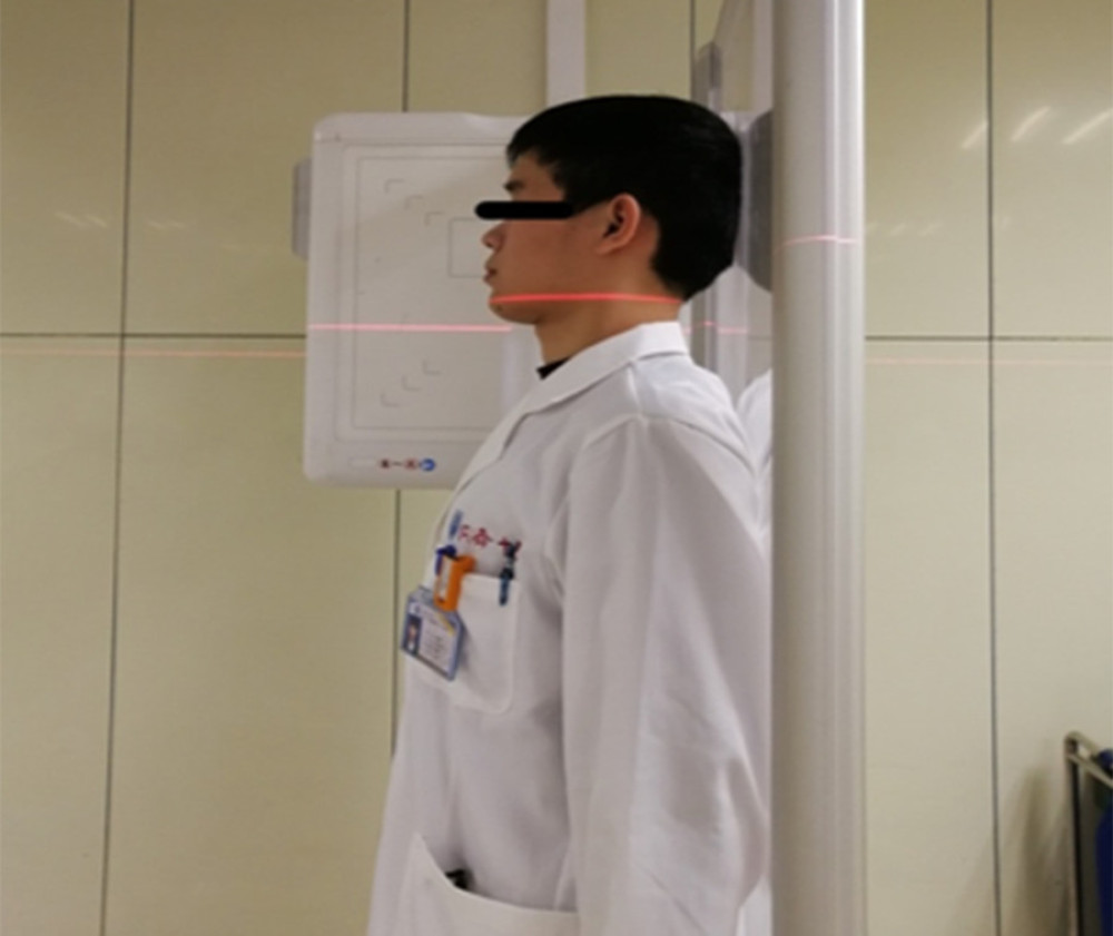 Patient stands in front of the camera frame with his right side close to it, and his back close to the vertical plate. The back side of his head, back, buttocks, legs, and both heels are required to cling to the vertical plate surface, which creates the neutral position of natural standing. The neck is placed in the middle line of the irradiation field, and the central line is vertically rayed into the camera frame through the side of the thyroid cartilage. The filming distance and equipment model are the same as those in regular position.