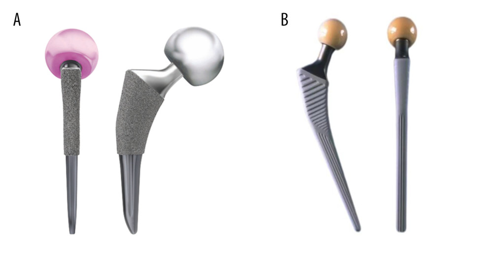 (A) Tri-lock femoral stem prosthesis. (B) Corail femoral stem prosthesis.