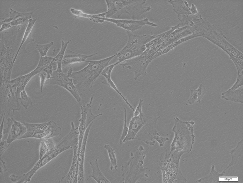 Mesenchymal stem cells from a 5-day culture. Bright field microscopy (BF), 200× magnification, using Xcellence RT system with an IX81 inverted microscope (Olympus).