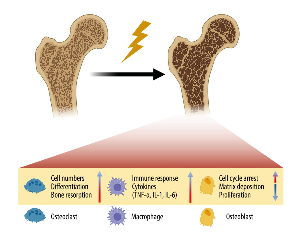 Schematic of the damage of radiation on bone. Radiation therapy (RT) can cause the development of osteoporosis and fragility fractures, mainly involving osteoclasts, osteoblasts and immune cells. The differentiation and number of osteoblasts are increased, making the bone resorption happen. While in osteoblasts, cell cycle arrest occurs, and the matrix deposition and proliferation rate are reduced. Meanwhile, the immune response is enhanced, and pro-inflammatory cytokines are secreted by immune cells. TNF-α – tumor necrosis factor-α; IL-1 – interleukin-1; IL-6 – interleukin-6. Created with BioRender.com.