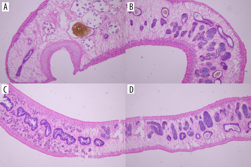 Pathology of adult Fasciola (hematoxylin and eosin stain, ×200 magnification). (A) is the head of the adult Fasciola; (B) is the body of the adult Fasciola; and (C, D) are tail of the adult Fasciola.