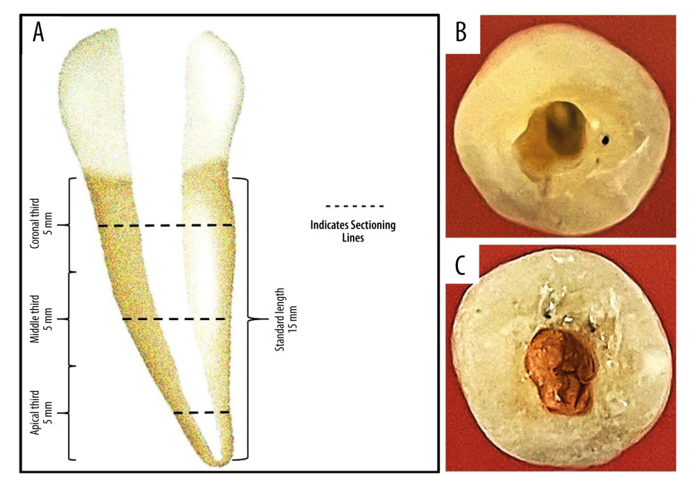 (A) Schematic depiction of the specimen measurements and their planned sections. (B) An exemplary specimen showing access cavity preparation. (C) An exemplary specimen showing the completed obturation. Figure created using MS PowerPoint, version 20H2 (OS build 19042,1466), Windows 11 Pro, (Microsoft corporation).