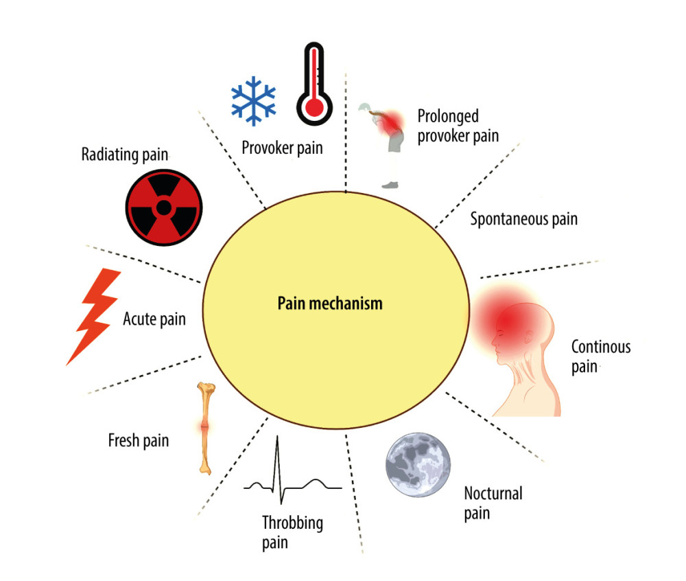 Mechanisms of painCreated with BioRender.com. With regard to the mechanism of pain formation in the oral cavity, a distinction is made between: provoked pain, prolonged provoked pain, spontaneous pain, continuous pain, nocturnal pain, throbbing (pulsating) pain, fresh pain, acute pain, and radiating pain.