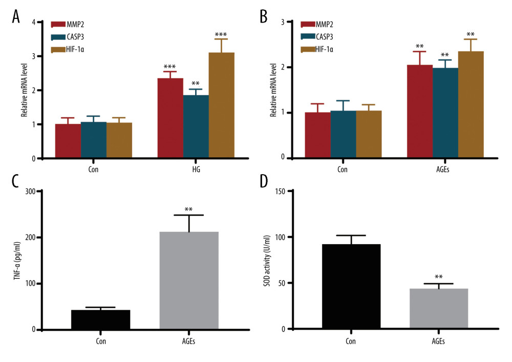 In vitro experiments verified the expression of hub genes. (A) Relative mRNA level of MMP2, CASP3, and HIF-1α in MPC5 cells treated with high glucose (HG). (B) Relative mRNA level of MMP2, CASP3, and HIF-1α in THP-1 cells treated with advanced glycation end products (AGEs). (C, D) The secretion of TNF-α and the activity of superoxide dismutase in THP-1 cells. *** Represents P<0.001; ** P<0.01. (GraphPad Prism version 8.0.).