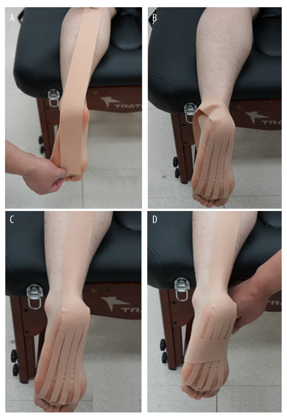 (A–D) Technique to apply of the kinesiology tape with ankle dorsi flexion.