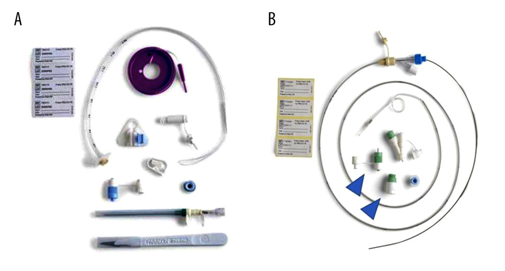 Percutaneous endoscopic transgastric jejunostomy (PEG-J) kit used in the procedures. Particles which are necessary for establishing gastrostomy are shown (A). A catheter and an accessory metallic guidewire are utilized for catheter placement (B). These particles are all included in a set.