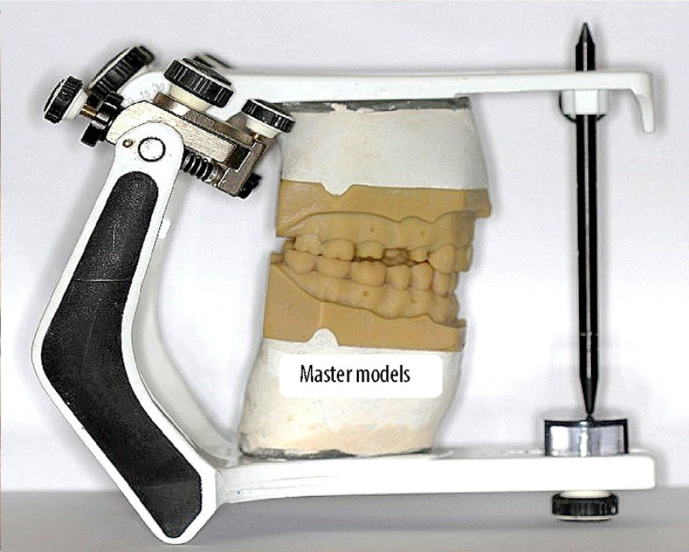 Master models mounted on a semi-adjustable articulator (BioArt A7 plus). Figure edited and labelled using MS PowerPoint, version 20H2 (OS build 19042,1466), windows 11 Pro, Microsoft corporation).
