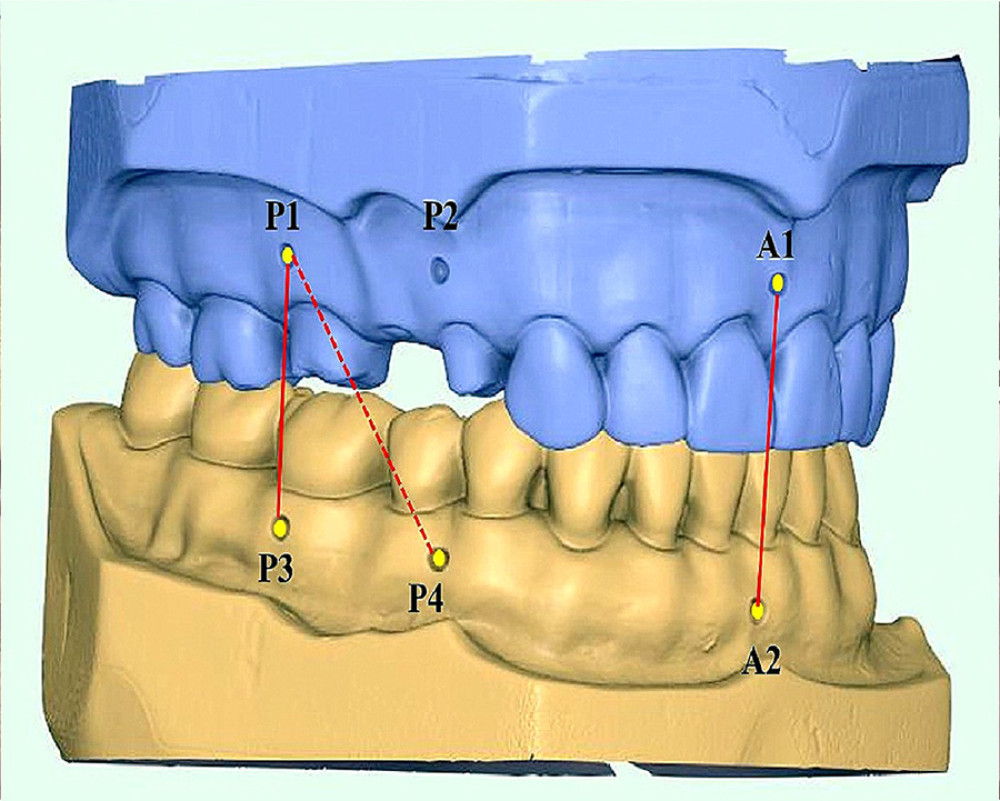 Three repeatable and reproducible indentations made on the maxillary and mandibular master models with A1 between maxillary central incisors, A2 between mandibular central incisors, P1 at right maxillary first molar, P2 between maxillary right first and second premolar, P3 at mandibular first molar and P4 between mandibular right first and second premolar. Figure edited and labelled using MS PowerPoint, version 20H2 (OS build 19042,1466), windows 11 Pro, Microsoft corporation).