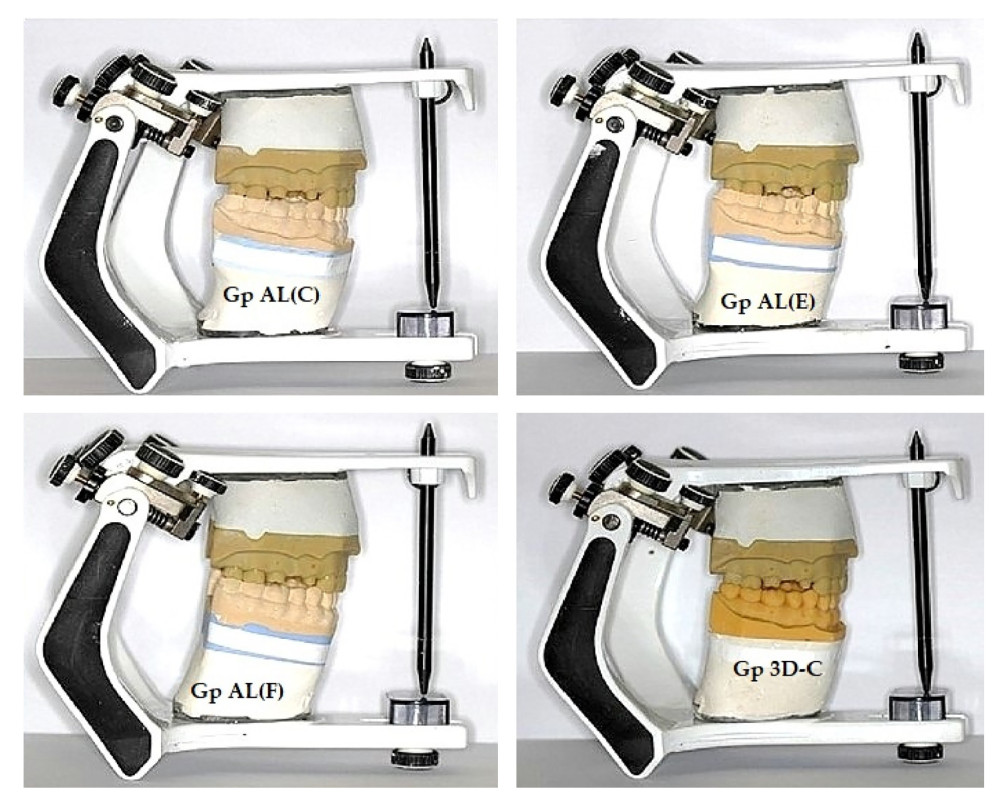 Four different mandibular casts mounted to the same maxillary master model cast on the semi-adjustable articulator using a maximum intercuspation bite registration record. Clockwise right - Hydrogum Alginate (Conventional) [Gp AL(C)], Hydrocolor 5 (Extended-Pour Alginate) [Gp AL(E)], 3D Print Dental Model (Gp 3D-C), FreeAlgin (Alginate Alternative) [Gp AL(F)]. Photographs taken using Digital Single-Lens Reflex (DSLR) (Canon EOS 700D) with 100 mm macro lens) with/without ring flash. Compiled Figure created using MS PowerPoint, version 20H2 (OS build 19042,1466), windows 11 Pro, Microsoft corporation)