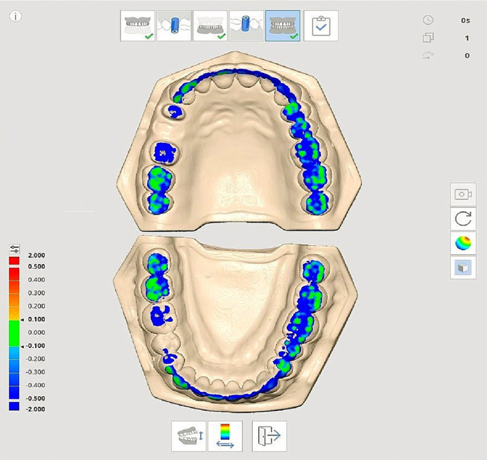 Medical Science Monitor Comparative Evaluation of Dimensional and