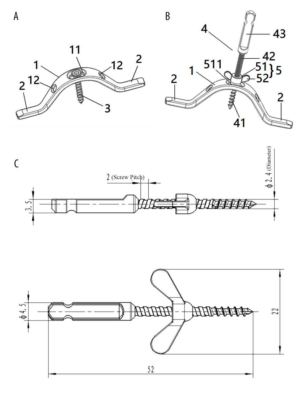 Structure diagram of the cross-bridge and lifting rod.(A) 1. Curved plate body (11. Laminar connecting orifice; 12. Fixing orifice); 2. Extend the fixed part; 3. Laminae fixation screws; (B) 1. Curved plate body; 2. Extension part; 4. Pull rod (41. First thread section; 42. Second thread section; 43. Standard quick interface); 5. Pull nut (51. Cylindrical body; 52. Drive lugs; 511. Tapered contact part). (C) Structure diagram of the lifting rod.