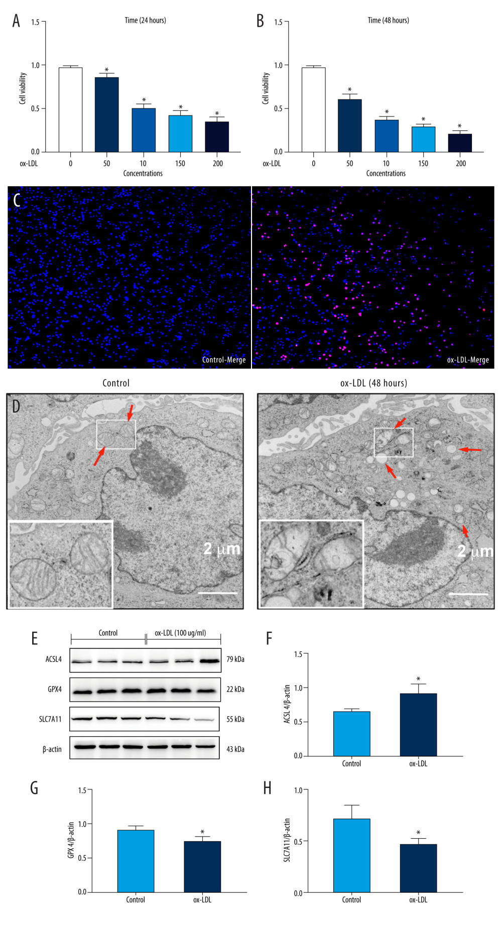 Oxidized low-density lipoprotein (ox-LDL) induced human umbilical vein endothelial cell (HUVEC) ferroptosis in a dose-dependent manner. (A, B) HUVEC metabolic activity was analyzed using Cell Counting Kit-8 (CCK-8) assay following treatment with ox-LDL (0–200 μg/mL; n=4). Statistical power=0.929356, effect size(r)=0.830181. (C) Hoechst/propidium iodide (PI) staining images were captured using fluorescence microscopy (Hoechst in blue, and PI in red; scale bars=100 μm). (D) The microscopic morphology of HUVECs under transmission electron microscope. (E) acyl-CoA synthetase long-chain family member 4 (ACSL4), glutathione peroxidase 4 (GPX4), and recombinant solute carrier family 7, member 11 (SLC7A11) protein expression levels were measured using Western blot analysis. (F–H) The results were normalized to controls, and histograms represent the relative intensities of ACSL4, GPX4, and SLC7A11. The data are expressed as the mean±SD (n=3–4 per group). Statistical power=0.913357, effect size(r)=0.804728. * P<0.05 vs the control group. # P<0.05 vs the ox-LDL group. Fluorescent images were evaluated using Olympus fluorescence microscopy with cellSens Dimension software (Version 1.3 rev, Olympus, Tokyo, Japan), and the positive cells was measured by Image Pro Plus 6.0 (Media Cybernetics, Rockville, MD, USA). Transmission electron microscopy (Talos L120C G2, FEI, Czech) was adopted to observe the morphology of HUVECs. The relative protein levels were quantified by Image J software (NIH, Bethesda, MD, USA). GraphPad Prism 9.0 software (La Jolla, USA) was used to analyze the data.