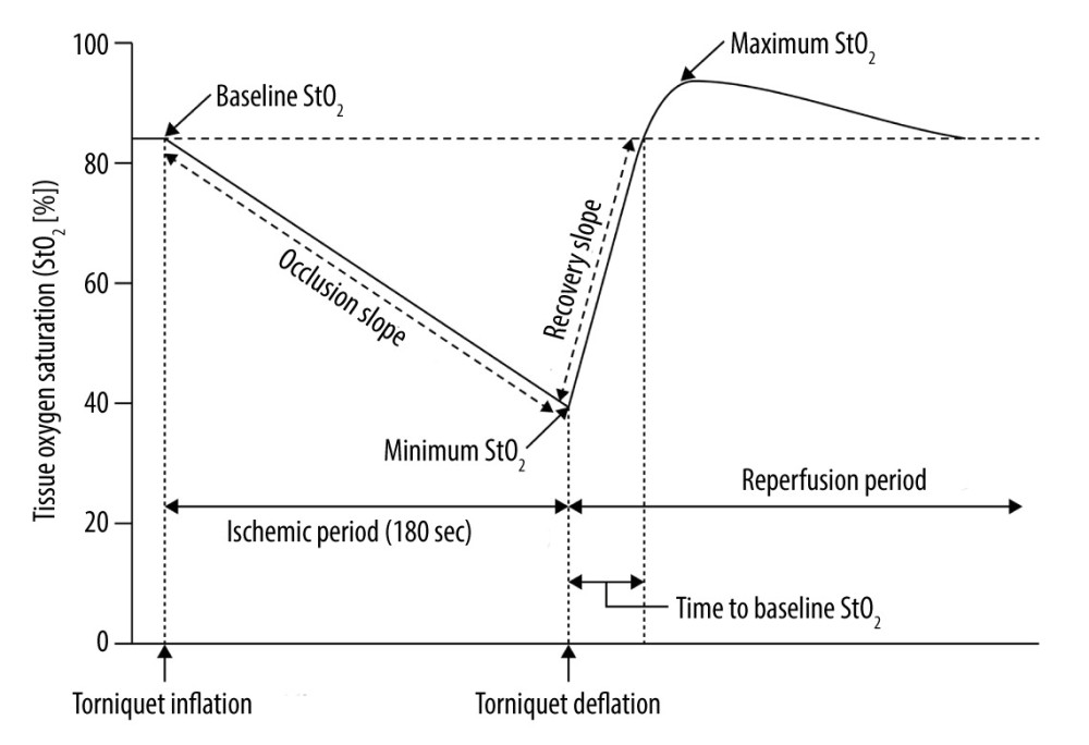 Changes in tissue oxygen saturation derived from near-infrared spectroscopy during vascular occlusion testsMicrocirculatory parameters derived from StO2 during vascular occlusion tests: baseline StO2, minimum StO2 during the ischemic period, maximum StO2 during the reperfusion period, time to reach baseline StO2 from deflation, occlusion slope (∇occl, slope of StO2 descent to the lowest value during tourniquet inflation), and recovery slope (∇recov, slope from the minimum to baseline StO2 during tourniquet deflation).