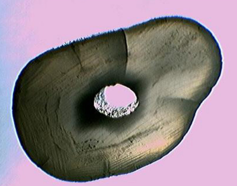 Cross sectional section of cracked root after stereomicroscopic observation.