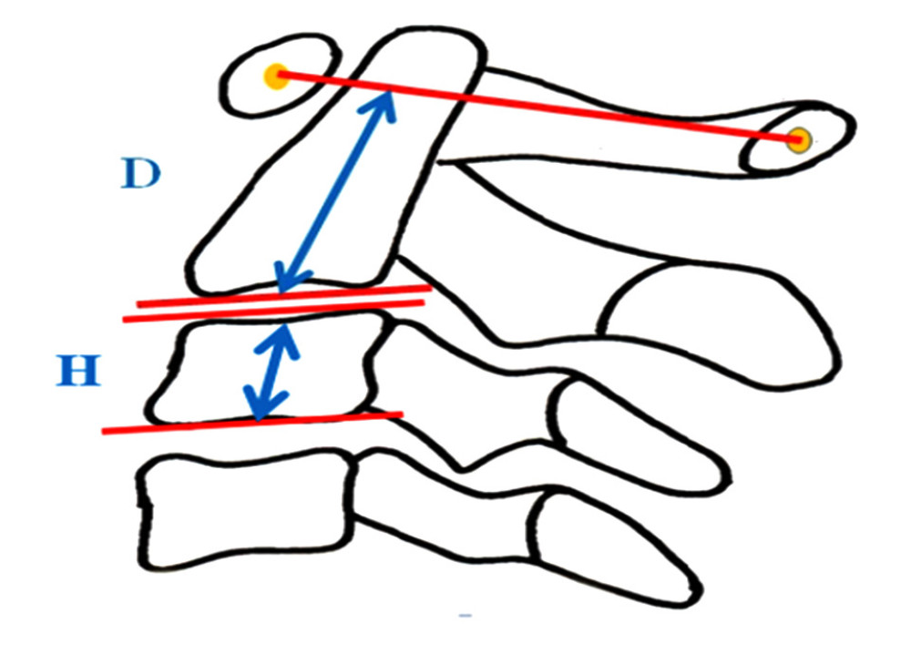 The measurement method of the Vertical Relationship Ratio (VRR): D/H, D: The distance between the midpoint of the base of C2 and a line from the center of the anterior and posterior arch of C1, H: mean of vertebral body height of C3 ((Anterior vertebral height+posterior vertebral height)/2). The figure was created using PowerPoint for Windows version 2311, Microsoft Corporation (Redmond, WA, USA).