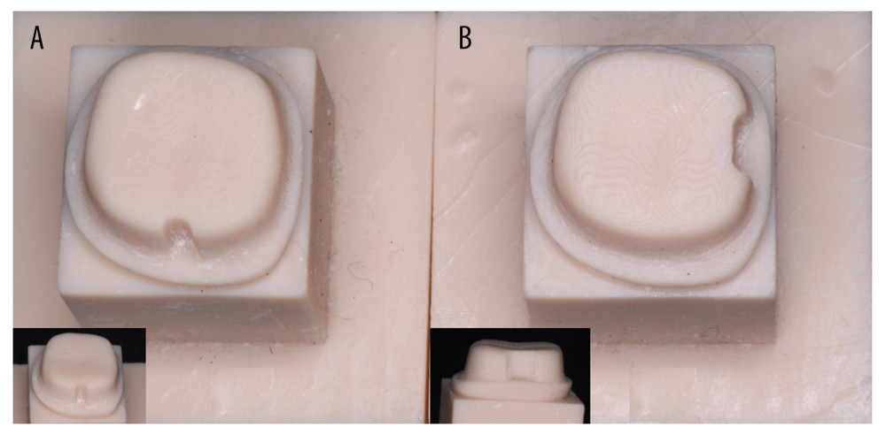Standardized resin dies after typhodont teeth preparations with 20-degree taper along with mid-buccal groove and distal proximal box. (A, B) insets showing close view of the groove and the box preparations. The photograph was captured with a Canon EOS 700D digital single-lens reflex camera equipped with a 100-mm macro lens. A ring flash may have been used, and the photograph was then compiled using MS PowerPoint, version 20H2, on Windows 11 Pro, developed by Microsoft Corporation.