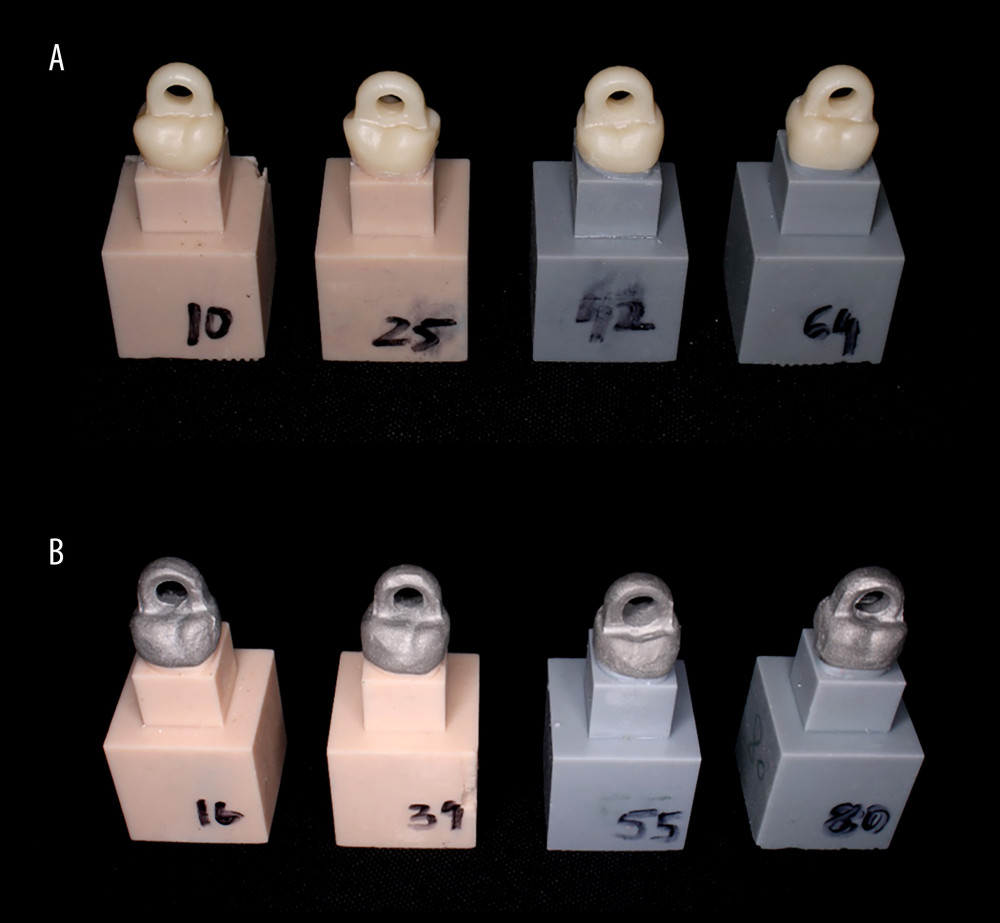 (A) Cemented definitive zirconia crowns on resin models of all groups. (B) Cemented definitive metal crowns on resin models of all groups.