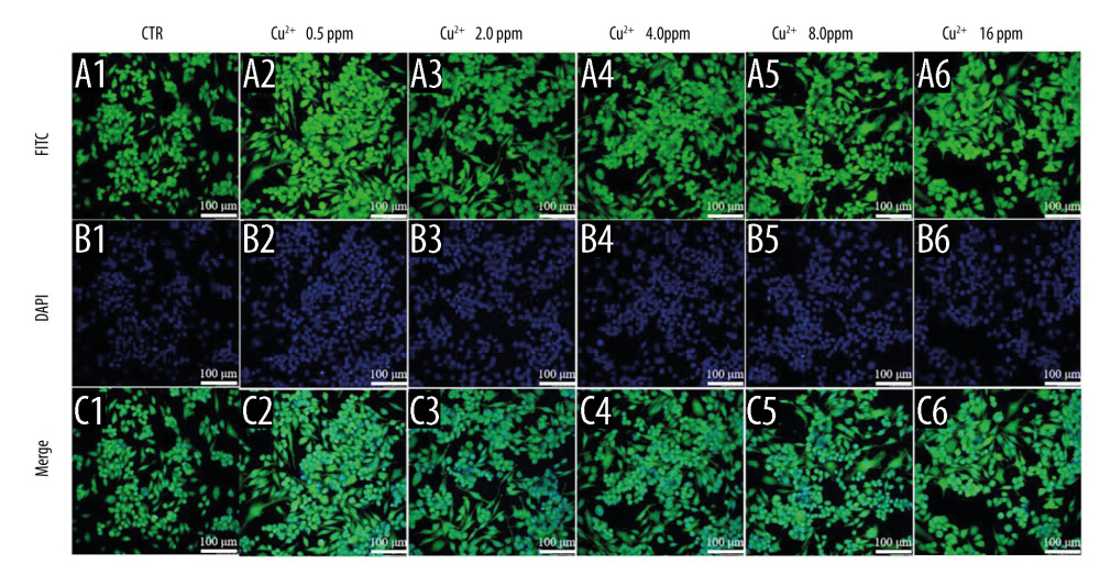 The morphology of macrophages incubated with different concentration of Cu2+ ions. The CLSM images characterized the morphology of macrophages, including FITC (A), DAPI (B) and Merge (C). (scale bar=100 μm)