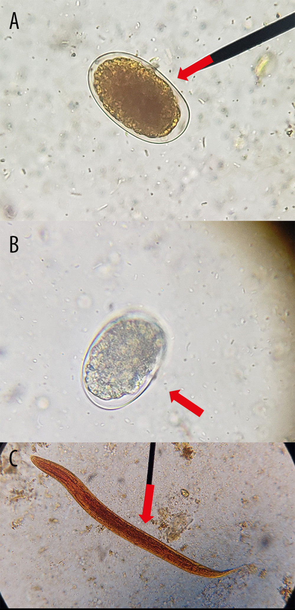 Microscopic identification of (A) egg of Ancylostoma caninum (red arrow) in feces of domestic dogs, (B) egg of Ancylostoma caninum (red arrow) in feces of rodent through the technique of sedimentation by centrifugation using saline solution and (C) larvae of Ancylostoma caninum in feces of domestic dog (red arrow) obtained by the technique of modified Baermann, observed by optical microscopy at 40× and stained/not with Lugol. (Taken by the authors).