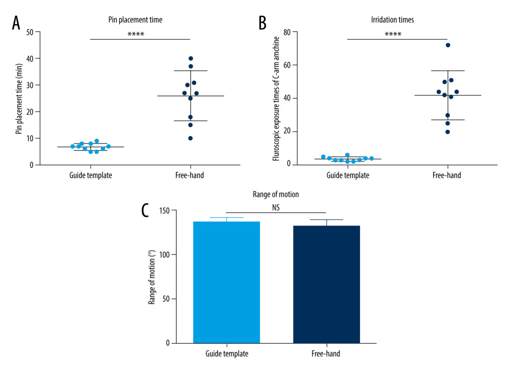 Comparison of pin placement time, fluoroscopic exposure times, and range of motion (ROM). (A, B) Scatter diagram: A scatter plot comparing pin placement time (A) and fluoroscopic exposure times (B) between the guide template and free-hand groups. Each data point represents a patient in the respective group. (C) Bar graph: A bar graph comparing the ROM between the 2 groups after surgery, showing no significant difference in elbow flexion-extension after the procedure. (**** P<0.0001). GraphPad Prism v10.0.0.3 (Insightful Science) was used for creation of the figure.