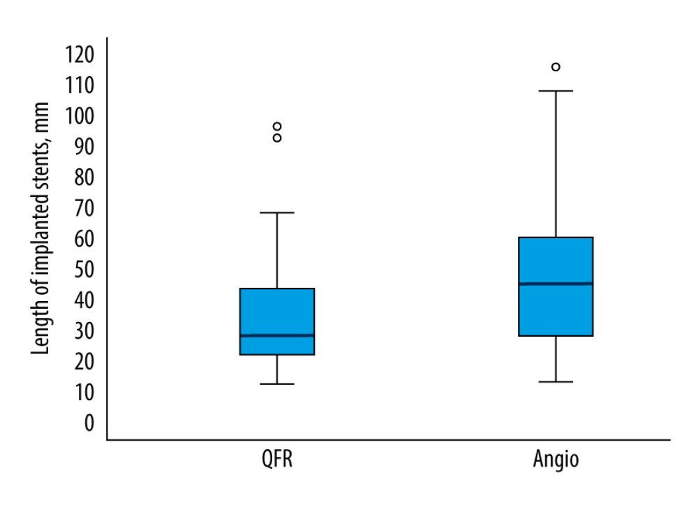 Length of implanted stents (mm) in quantitative flow ratio (QFR)-guided and angiography-guided percutaneous coronary intervention (PCI) groups during second-stage stenting procedure. This box plot illustrates the significantly shorter implanted stent length in the QFR-guided group than in the angiography group during the second-stage stenting procedure (33.18±2.26 mm vs 47.69±3.11 mm). P<0.001, based on the nonparametric Mann-Whitney test.