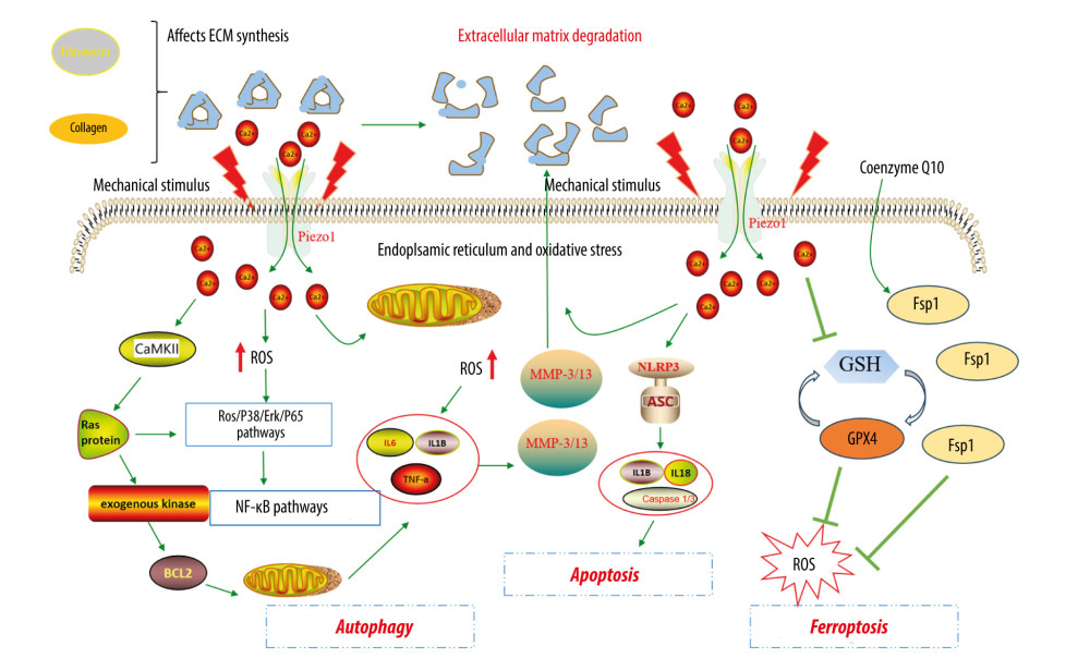 Molecular mechanism of microenvironmental changes induced by abnormal mechanical pressure in knee osteoarthritis.