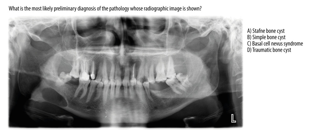 All chatbots gave correct answers to the Stafne bone cyst case.
