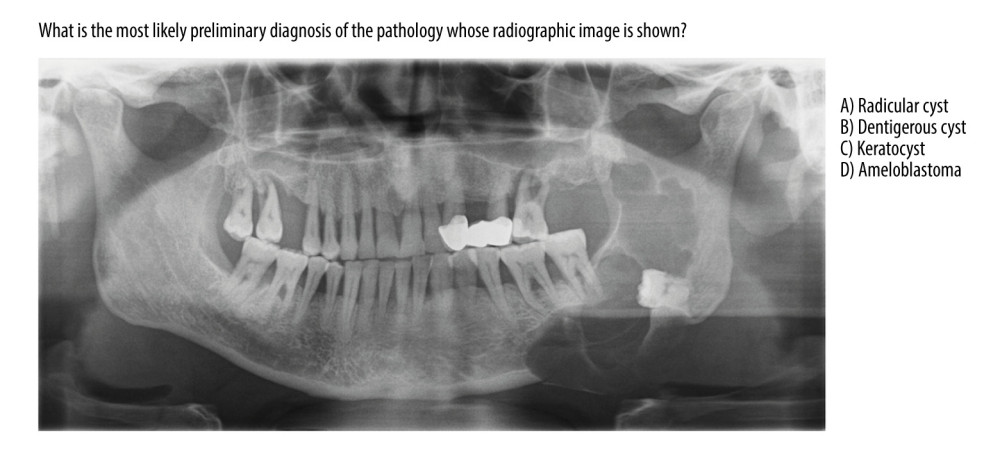 All chatbots gave incorrect answers to the dentigerous cyst case.