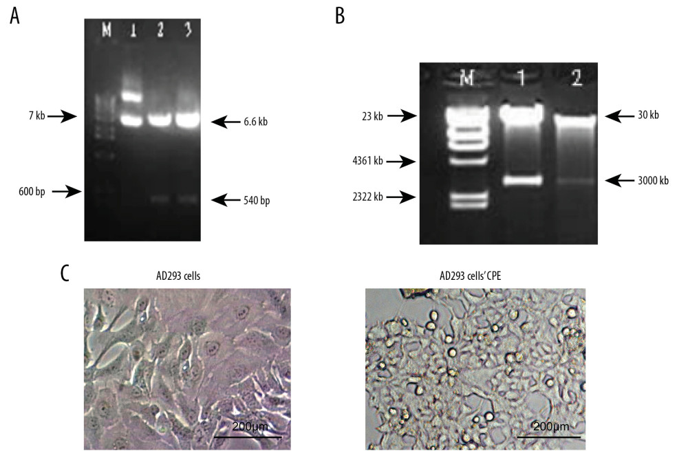 Restriction mapping and cytopathic effect (CPE) on AD293 cells transfected with the adenoviral plasmid. (A) Shuttle plasmid pShuttle-JAZF1 (lane M): wide-range DNA marker; (lane 1): Recombinant plasmid pShuttle (6.6 kb); (lane 2, 3): pShuttle-JAZF1 digested by XhoI and EcoRI (540 bp). (B) Recombinant plasmid pAD-JAZF1 (lane M): λhindIII digestion, up to 23 kb; (lane 1, 2): pAd-JAZF1 digested by PacI. (C) AD293 cells and the CPE.