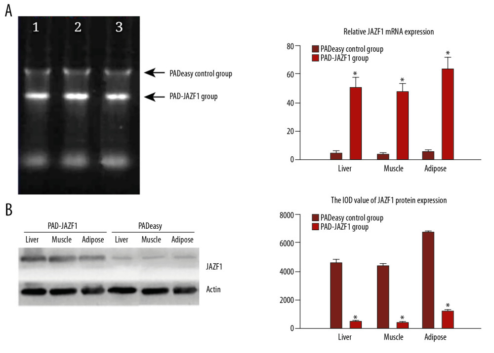 mRNA and protein expression levels of JAZF1 in mouse liver, muscle, and adipose tissues in the PAD-JAZF1 and control groups. (A) JAZF1 mRNA expression levels in the 2 groups. Lane 1, liver; lane 2, muscle; lane 3, adipose tissue 4. (B) JAZF1 protein expression levels in the PAD-JAZF1 and control groups.