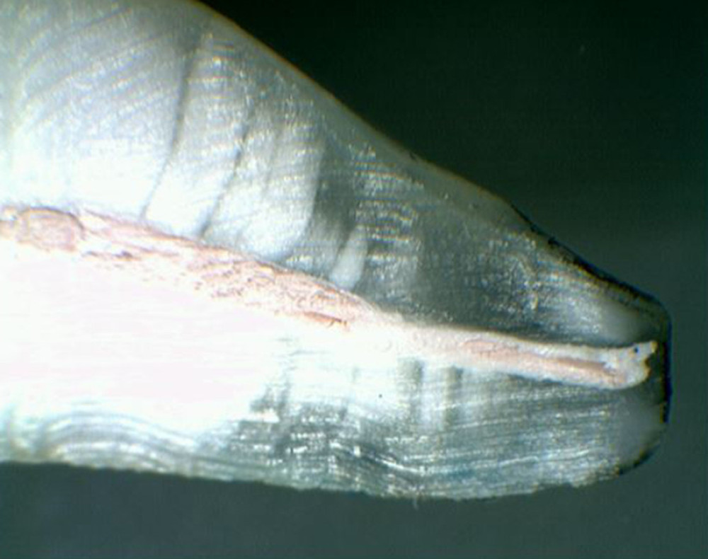 Apical dye leakage after the crown-down preparation technique and filling with the Resilon/Epiphany system.
