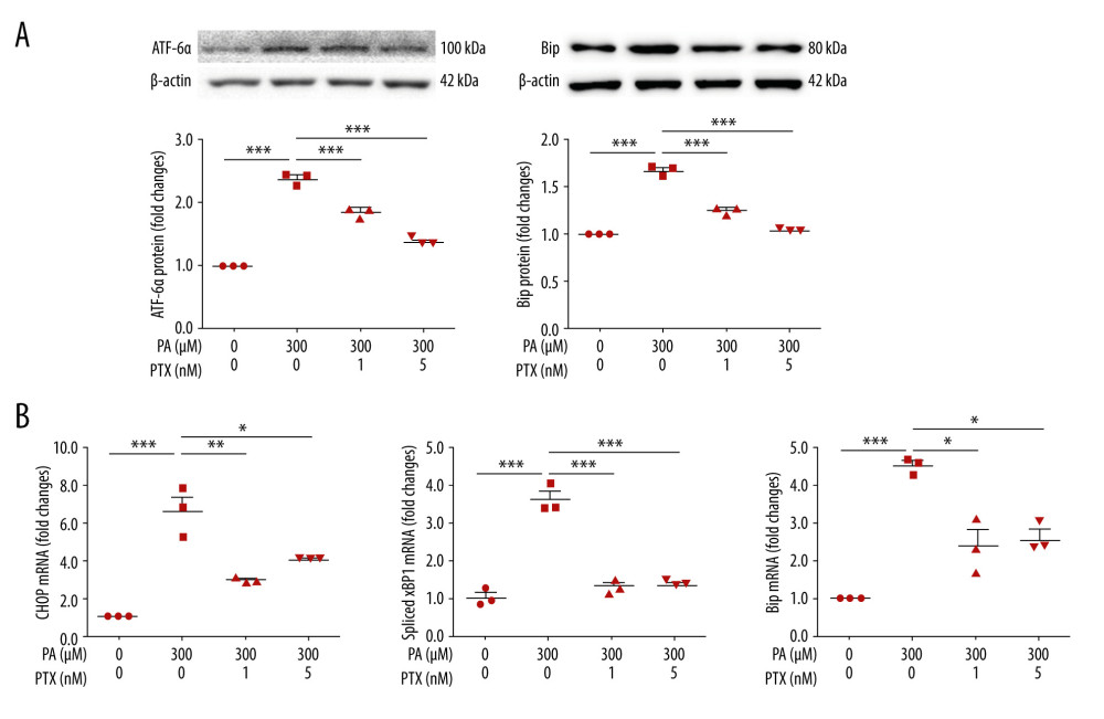 Effect of paclitaxel on palmitate-induced ER stress. Podocytes were treated with 300 μM palmitate with or without paclitaxel for 24 h. (A) Western blots (top) and densitometry (bottom) for ATF-6α and Bip. (B) Real-time PCR for CHOP, spliced XBP1, and Bip was normalized by β-actin mRNA level in the same sample. Error bars represent the mean±SEM. (n=3). BSA – bovine serum albumin; PA – palmitate; PTX – paclitaxel. * P<0.05, ** P<0.01, *** P<0.001 compared with palmitate.