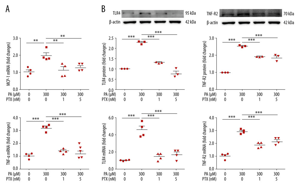 Effect of paclitaxel on palmitate-induced inflammation. Podocytes were treated with 300 μM palmitate with or without paclitaxel for 24 h. (A) Real-time PCR of MCP-1 (top) and TNF-α (bottom) were normalized by β-actin mRNA level in the same sample. Error bar represents the mean±SEM (n=4). (B) TNF-R2 and TLR4 mRNA was normalized by β-actin mRNA level in the same sample. Western blots, densitometry (top, n=3) and mRNA expression are shown (bottom, n=4). Bar represent the mean±SEM. BSA – bovine serum albumin; PA – palmitate; PTX – paclitaxel. ** P<0.01, *** P<0.001 compared with palmitate.