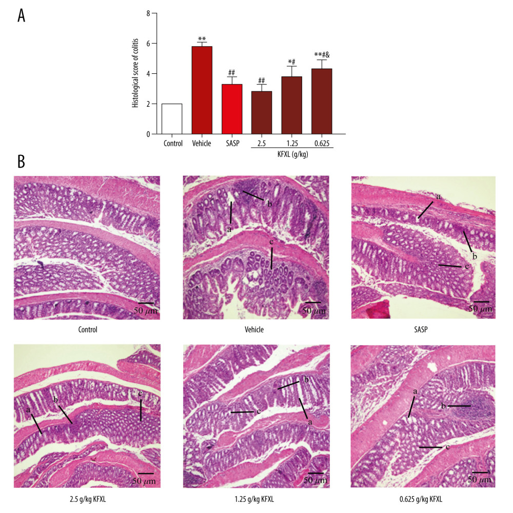 The effect of KFXL on histopathology of acute UC mice. (A) Effect of KFXL on histopathology colitis score for all groups. (B) Histopathology colitis of DSS-induced acute ulcerative colitis in mice treated with different doses of KFXL and SASP and normal mice by H&E staining. Original magnification ×200. a, goblet cells; b, inflammatory cells; c, crypt cells. * P<0.05, ** P<0.01 compared with the normal control group; # P<0.05, ## P<0.01 compared with the DSS-induced group (Vehicle); & P<0.05, && P<0.01 compared with the SASP group.