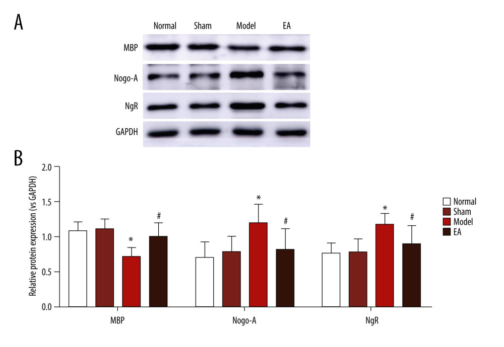 Effect of electroacupuncture (EA) on myelin basic protein (MBP), Nogo-A, and Nogo-A receptor (NgR) protein expression was examined through western blotting. (A) The bands of MBP, Nogo-A, NgR, and GAPDH protein. (B) Quantitative results of MBP, Nogo-A, and NgR protein. Values are expressed as mean±standard deviation (n=5), * P<0.05 compared with sham-operated group and # P<0.05 compared with model group.