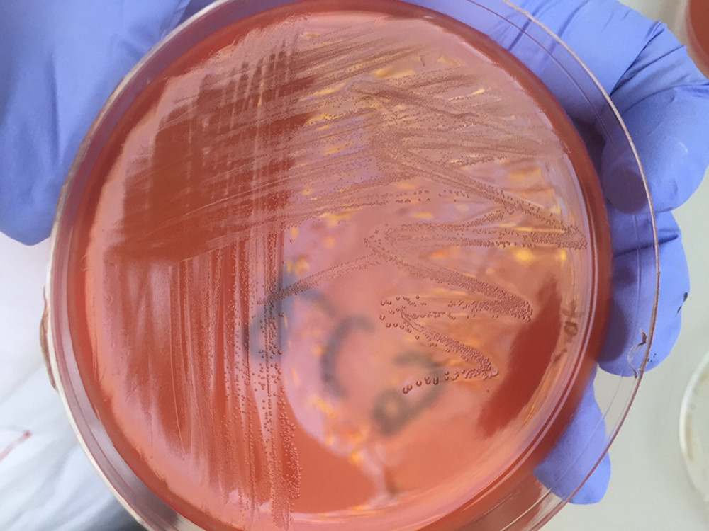 Confirmation of Enterococcus faecalis presence in lower chamber broth after growth on blood agar.