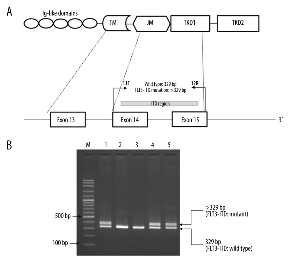 Identification of FMS-like tyrosine kinase 3 (FLT3)-internal tandem duplication (ITD) mutation by PCR. (A) Locations and orientations of primers used for identification of FLT3-ITD mutation. Primers 11F and 12R were used to amplify FLT3-ITD mutant and FLT3-wild type at exons 14–15. The 329 bp fragment indicates the wild type while the fragment larger than 329 bp indicates the FLT3-ITD mutation. TM – transmembrane domain; JM – juxtamembrane domain; TKD – tyrosine kinase domain. (B) A representative 2% agarose gel electrophoresis of PCR products. Lane 1 and lane 2 are positive and negative control for the FLT3-ITD mutation, respectively. Lanes 3–5 are PCR products of patients with acute myeloid leukemia. Lane 3 shows the 329 bp fragment indicating the wild type. Lane 4 & 5 show the 329 bp and the fragment larger than 329 bp (>329) indicating FLT3-ITD mutation. M indicates 100 bp DNA ladder.