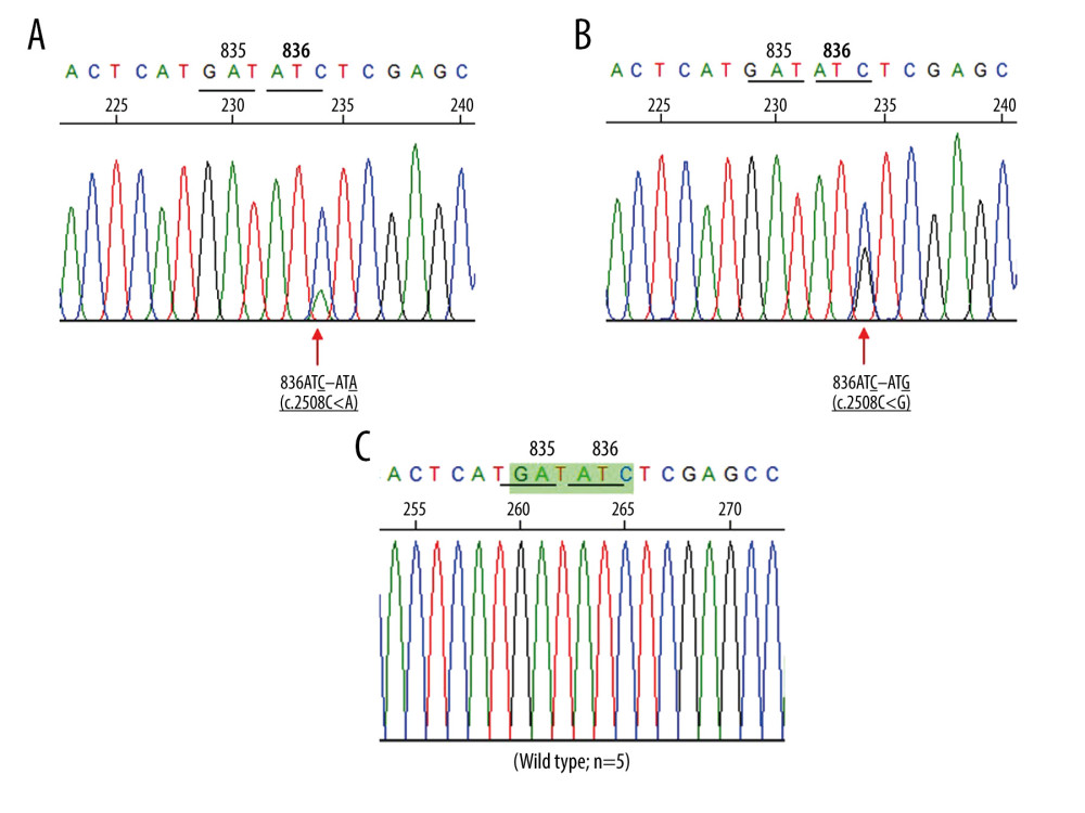 (A, B) Direct sequencing in the forward direction demonstrating 2 novel FMS-like tyrosine kinase 3 (FLT3)-TKD mutations among AML patients. Red arrow indicates the mutation site. The mutation and 836ATC – ATG mutation, respectively. (C) The corresponding DNA sequence of AML patients with wild type FLT3-TKD at the same region.