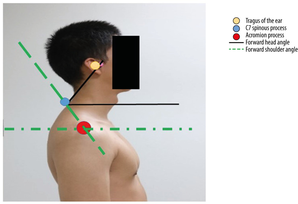 Body markers for posture analysis and measurement of forward head angle and forward shoulder angle by using.