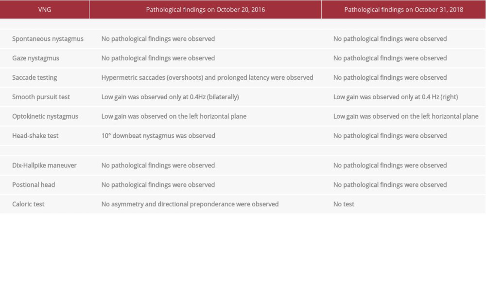 The patient’s videonystagmography (VNG) findings.