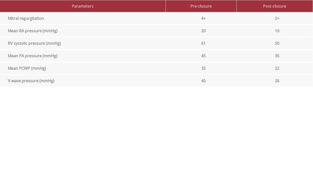 Parameters before and after closure of the mitral paravalvular leak.