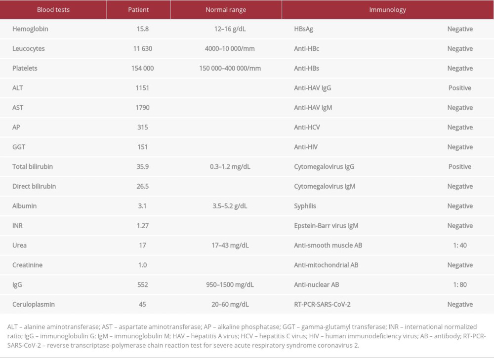 Initial laboratory tests.