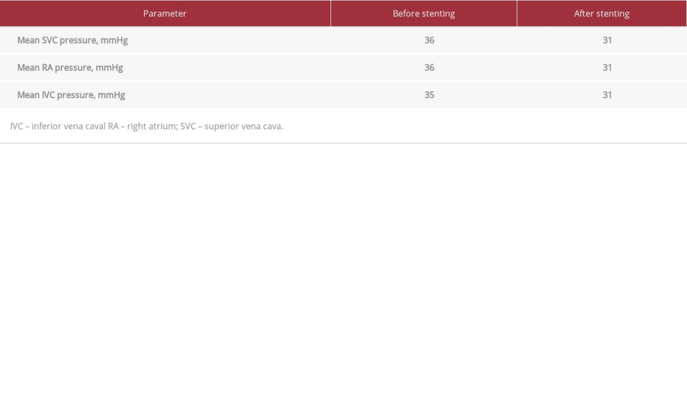 Change in vena cava and right atrium pressure before and after stenting.