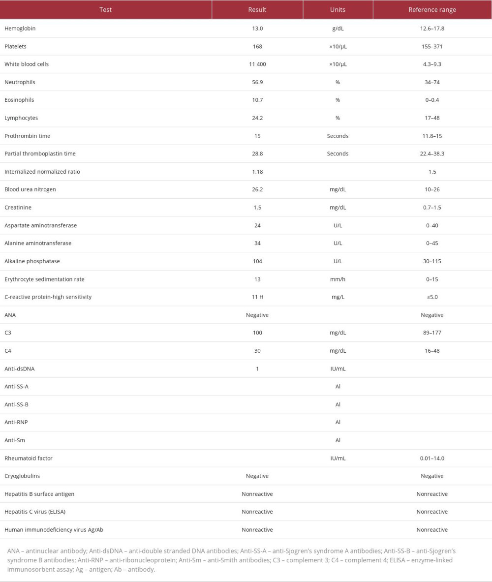 Pertinent laboratory values of an 89-year-old male patient presenting with a drug-induced purpuric cutaneous eruption secondary to linezolid use. The table includes blood count, metabolic panel, and autoimmune, vasculitis, and infectious work-ups.