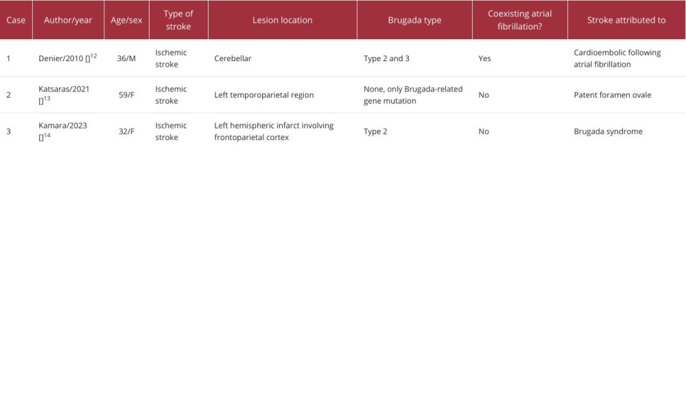 Reported cases of ischemic stroke coexisting with Brugada syndrome obtained from the literature review.