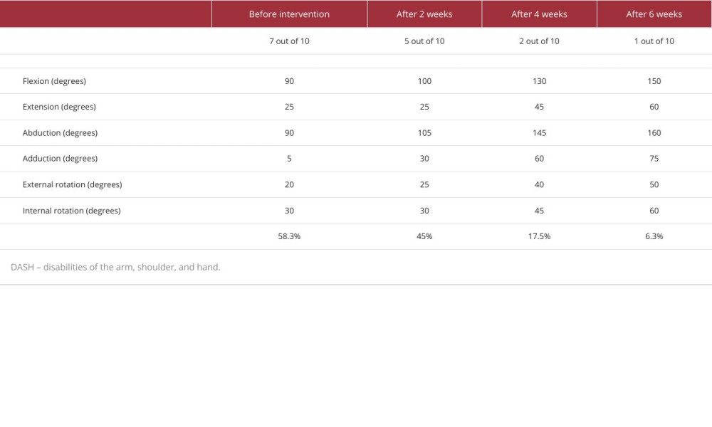 The NRS, ROM, and DASH scores of our patient before and after a 6-week prolotherapy intervention combined with physical therapy and at follow-up.