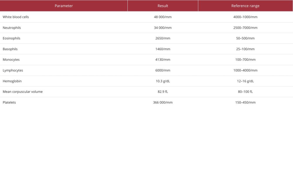 Complete blood count with differentials.